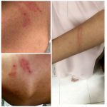 مكة .. مدير مدرسة أهلية يضرب طالبًا بـ"ليّ" مسببًا له كدمات متفرقة بجسده