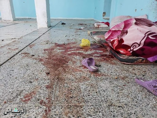 مجزرة شنيعة.. ميليشا الحوثي تقصف سجن تعز بصاروخ ومقتل 30 امرأة